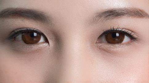 上眼皮松弛是什么原因引起的？