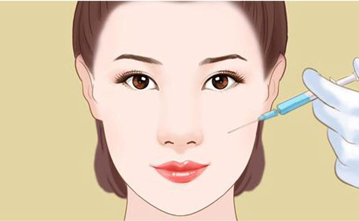 膠原蛋白豐唇效果怎么樣？膠原蛋白豐唇多少錢？