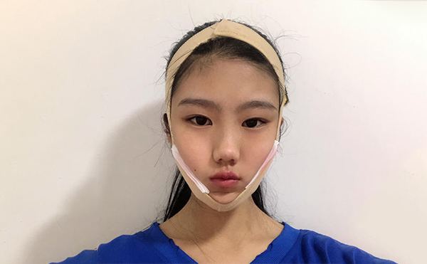 想要確保下頜角整形手術(shù)順利和術(shù)后效果，術(shù)前應(yīng)該做哪些攻略?