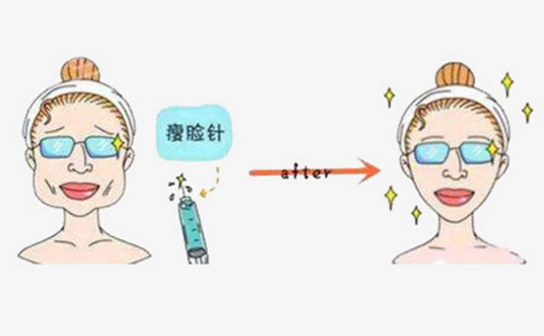 是否會(huì)對(duì)瘦臉針產(chǎn)生依賴?