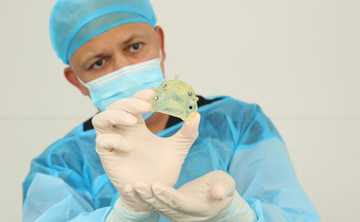 貴金屬烤瓷牙有哪些？貴金屬烤瓷牙的種類