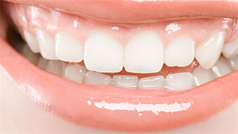 鑲牙和種牙哪種比較好？