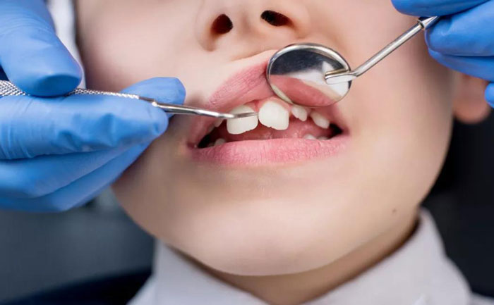 小孩牙齒矯正最佳年齡？小孩牙齒矯正價(jià)格多少錢？