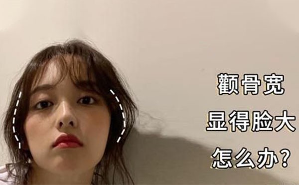 如何改善顴骨過寬?