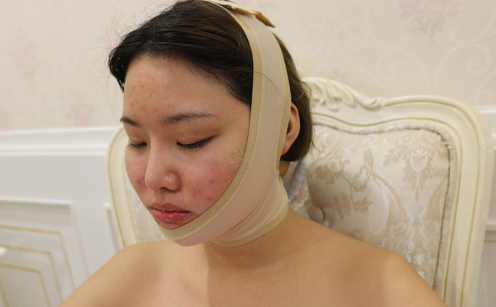 面部吸脂修復手術多少錢？面部吸脂會反彈嗎？