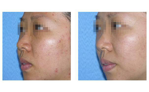 復合彩光多少錢？