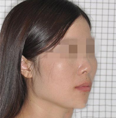 科技發(fā)達(dá)人人都可以矯正