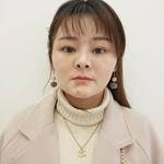 鼻基底整形案例對比2