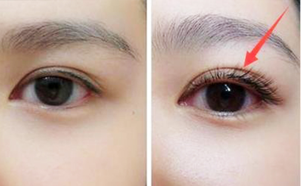 濃密的睫毛簡直就是大眼必備，濃密又卷翹的睫毛可以讓眼睛看起來更加有神亮眼，成功化身“睫毛精”。但是不少人睫毛稀疏、塌睫毛、夾不翹睫毛，有些小仙女的睫毛還特別雜亂，并不美觀，無睫毛星人該如何拯救顏值。倒睫與亂睫的區(qū)別是什么?倒睫與亂睫怎么辦?