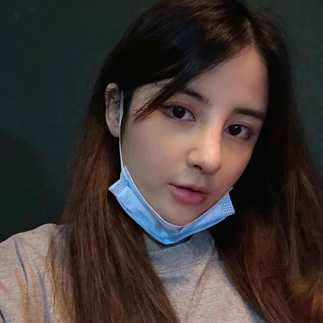 隆鼻手術(shù)術(shù)后效果