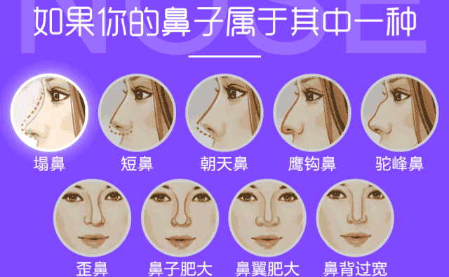 自體脂肪隆鼻可以保持多久？