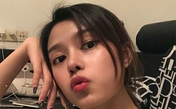 隆鼻術(shù)后兩個月