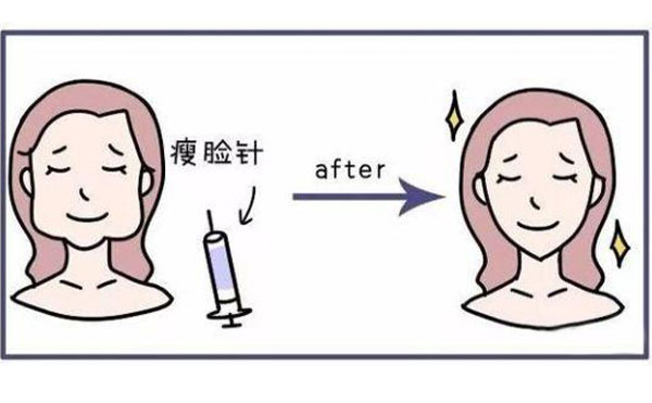瘦臉針有什么功能？