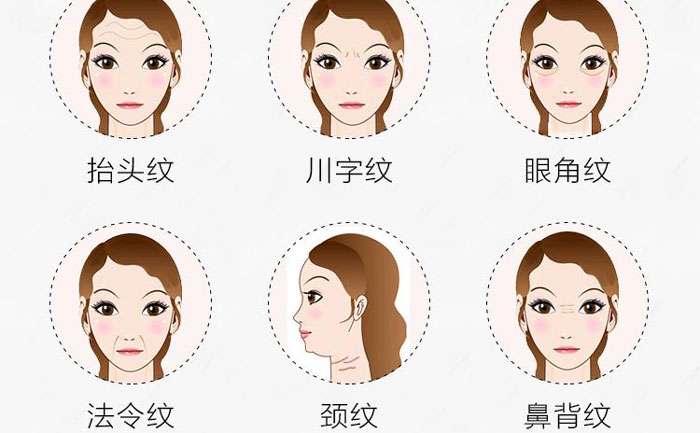 botox除皺針有哪些副作用？