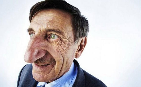 大鼻頭如何變??？鼻頭大怎么改善？