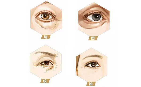 眼部凹陷是什么導(dǎo)致的?眼部凹陷怎么解決?