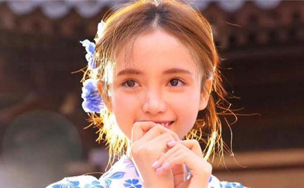 愛貝芙墊下巴適合什么樣的人?術(shù)后護(hù)理要點(diǎn)有哪些?