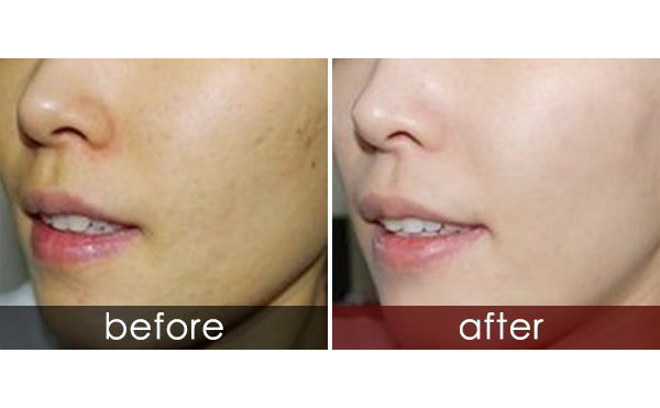 白瓷娃娃適合人群有哪些？