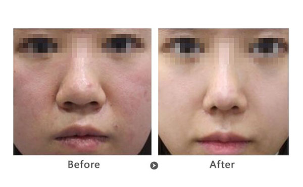 做黑臉娃娃前要注意什么？