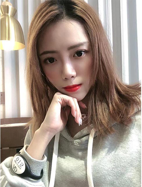 肋軟骨鼻綜合案例：術后效果2