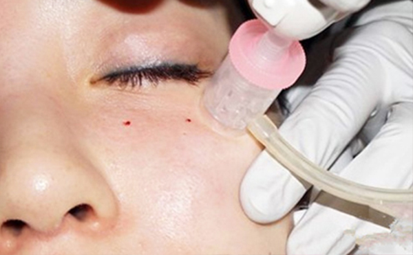 水光針和皮秒哪個好？