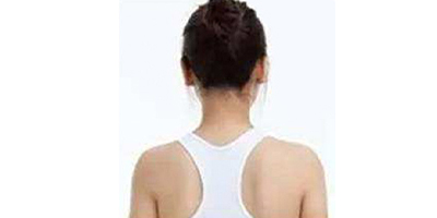 超聲溶脂瘦肩部術(shù)后