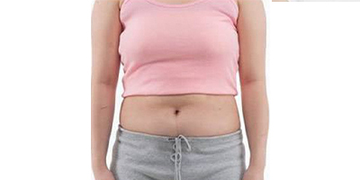 超聲溶脂瘦腹部術(shù)前