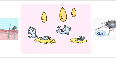 溶解酶術(shù)后