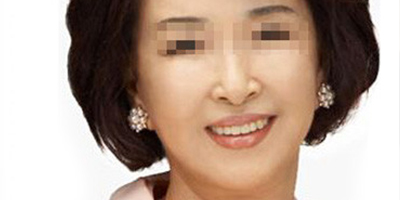 熱拉提術(shù)后