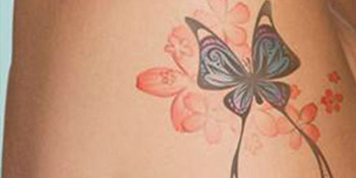 激光去紋身術前