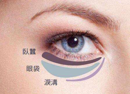 眼袋失敗修復(fù)要怎么處理？切眼袋需要多長(zhǎng)時(shí)間恢復(fù)？