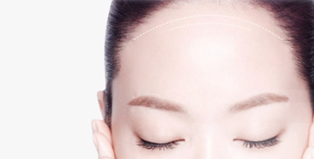 自體脂肪豐額頭效果怎么樣？自體脂肪豐額頭效果可以保持多久？