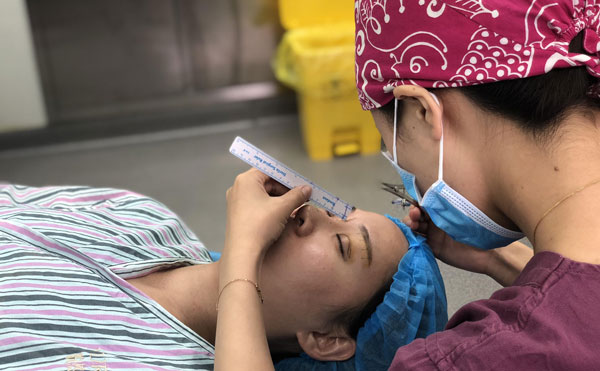 超體隆鼻怎么樣，能保持多久？超體隆鼻可能出現(xiàn)的副作用有哪些？