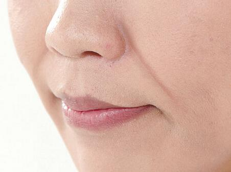 注射填充法令紋的方式有哪些？如何通過醫(yī)美手段祛法令紋？