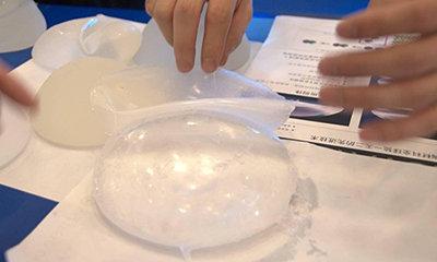 假體隆胸多少錢大概？假體隆胸多久能變軟？