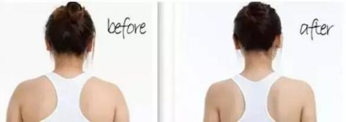 冷凍溶脂可以瘦肩膀嗎 冷凍溶脂瘦肩膀適應(yīng)癥狀是什么