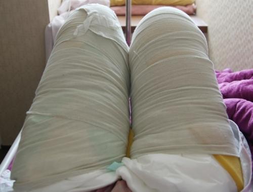 射頻溶脂瘦大腿一次有用嗎 射頻溶脂瘦大腿多久有效果