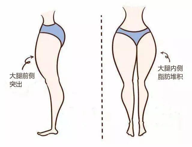 隔空溶脂瘦大腿有什么副作用 隔空溶脂瘦大腿如何護理