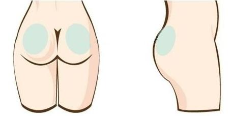 隔空溶脂瘦臀部多少錢 隔空溶脂瘦臀部術(shù)后效果怎么樣