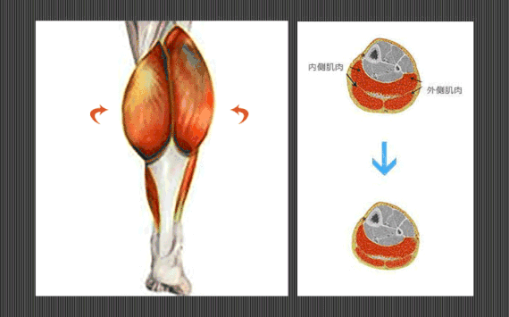 小腿肌肉阻斷術(shù)是什么？小腿神經(jīng)阻斷術(shù)的后遺癥有嗎？