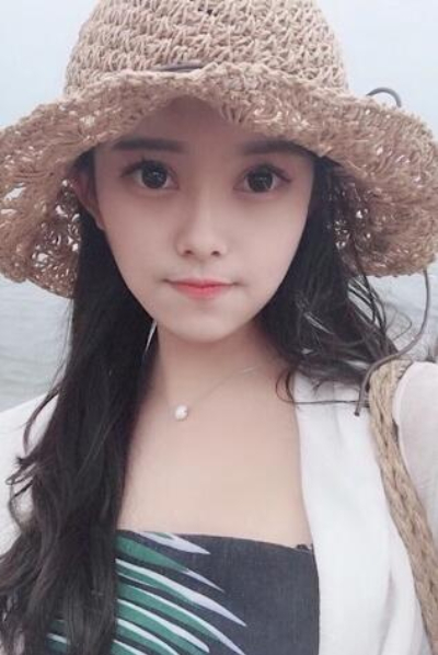 上海新健威醫(yī)療美容門(mén)診部做雙眼皮手術(shù)后三天的情況