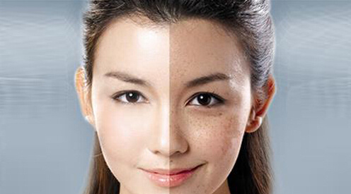 鐳射凈膚的原理功效 ？鐳射凈膚和m22是一種東西嗎？