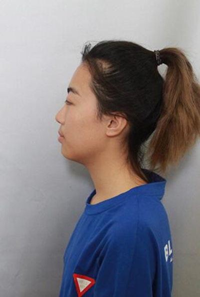 上海美萊醫(yī)療美容門診部做隆胸手術(shù)前的狀態(tài) 上海美萊醫(yī)療美容門診部做隆胸手術(shù)前的狀態(tài)