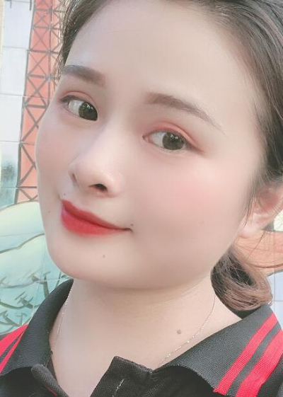 長(zhǎng)春中妍醫(yī)療美容醫(yī)院做雙眼皮手術(shù)后的最終效果 長(zhǎng)春中妍醫(yī)療美容醫(yī)院做雙眼皮手術(shù)后的最終效果