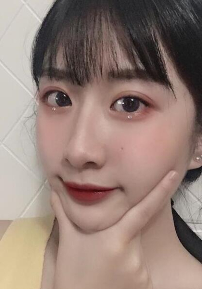 珠海陸達(dá)美容外科醫(yī)院做下頜角后完成小臉的蛻變 珠海陸達(dá)美容外科醫(yī)院做下頜角后完成小臉的蛻變