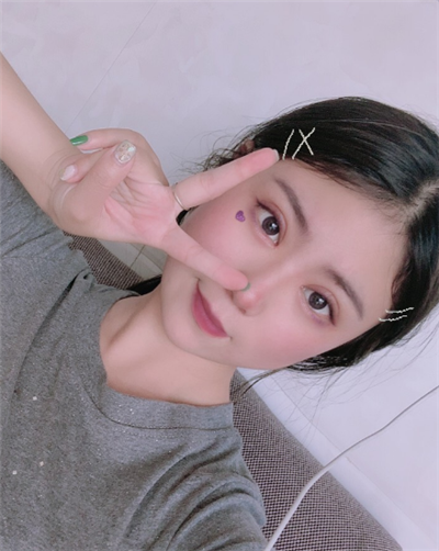 溫州友好醫(yī)院整形美容中心做雙眼皮手術(shù)的一周后 溫州友好醫(yī)院整形美容中心做雙眼皮手術(shù)的一周后