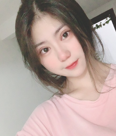 溫州友好醫(yī)院整形美容中心做雙眼皮手術(shù)10天后 溫州友好醫(yī)院整形美容中心做雙眼皮手術(shù)10天后