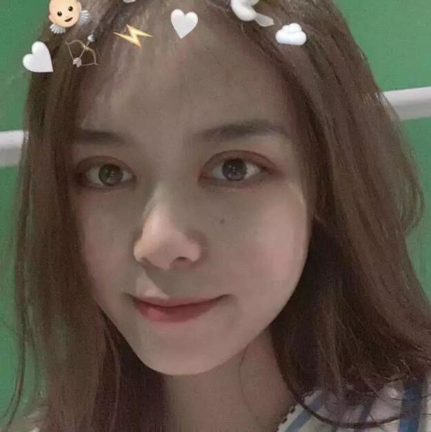 鄭州壹加壹王洛生全切雙眼皮案例術后一個月 鄭州壹加壹王洛生全切雙眼皮案例術后一個月