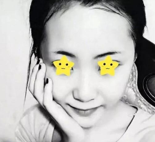 上海首爾麗格安建榮鼻綜合真人案例術前