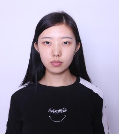 第四軍醫(yī)大學(xué)唐都醫(yī)院李望舟雙眼皮案例術(shù)前 第四軍醫(yī)大學(xué)唐都醫(yī)院李望舟雙眼皮案例術(shù)前